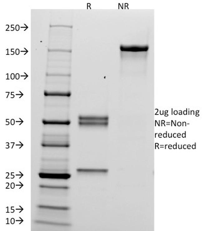 HCG-alpha Antibody in SDS-PAGE (SDS-PAGE)