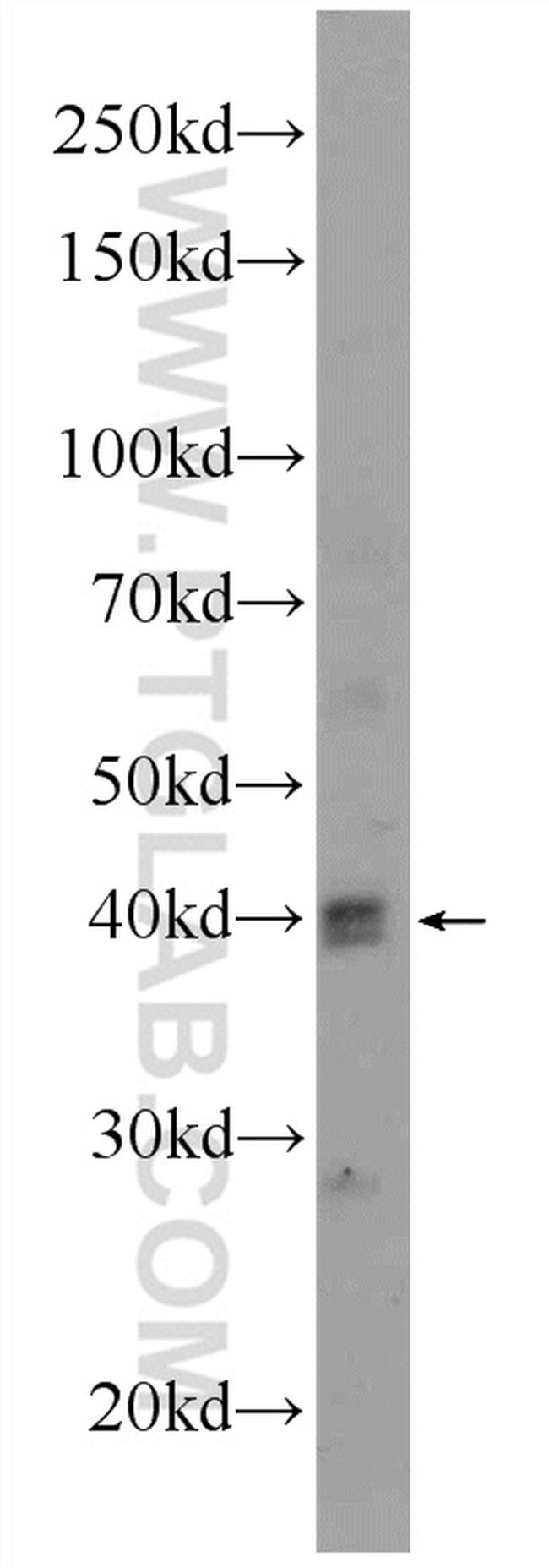 BMI1 Antibody in Western Blot (WB)