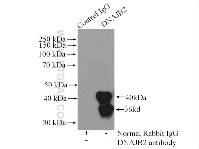 DNAJB2 Antibody in Immunoprecipitation (IP)