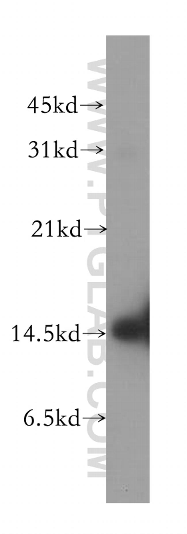 alpha-synuclein Antibody in Western Blot (WB)