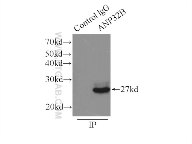 ANP32B Antibody in Immunoprecipitation (IP)