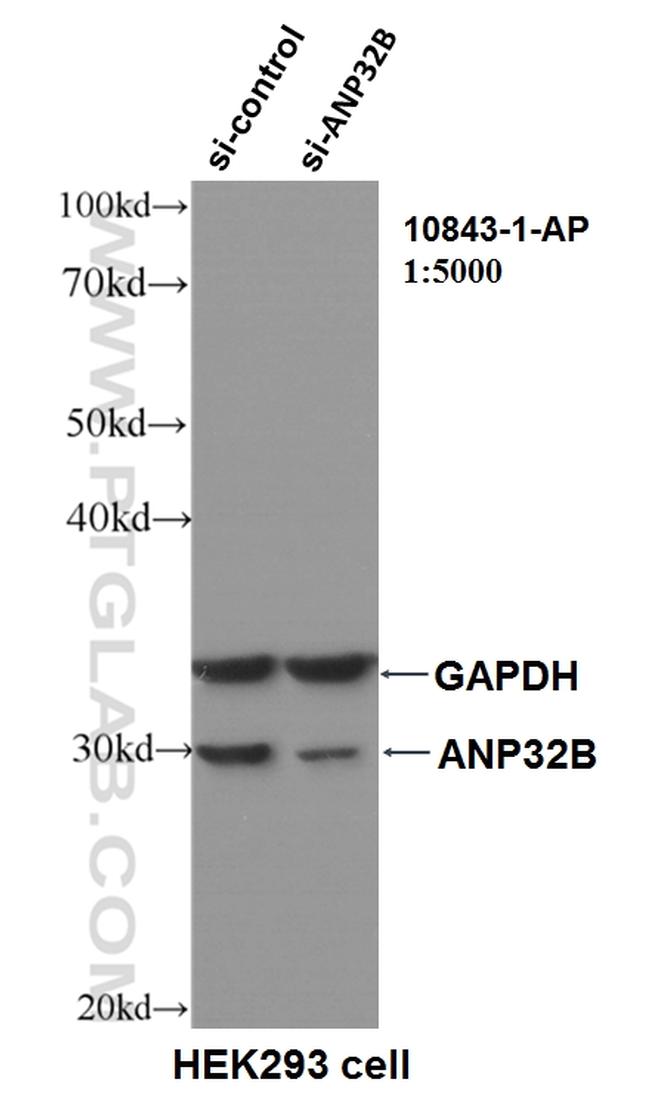 ANP32B Antibody in Western Blot (WB)