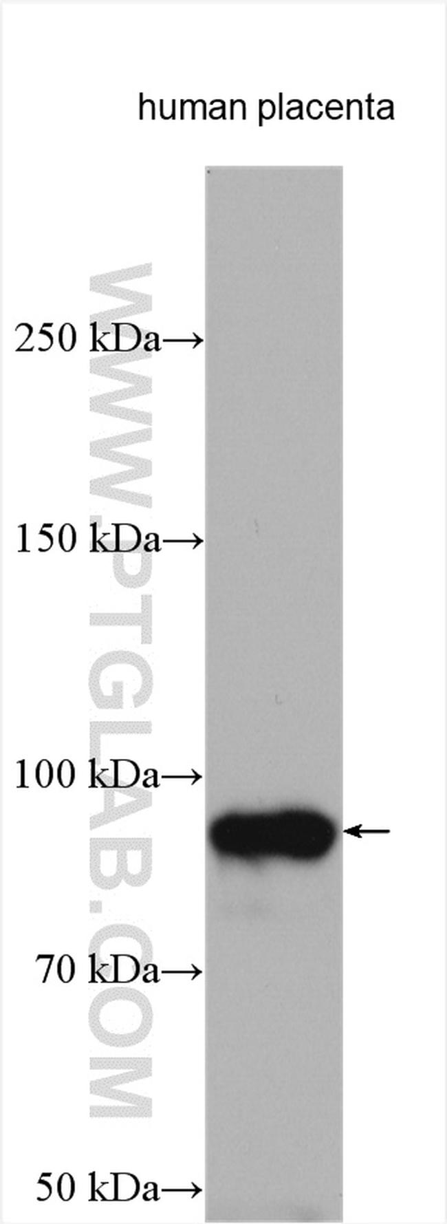 Endoglin/CD105 Antibody in Western Blot (WB)