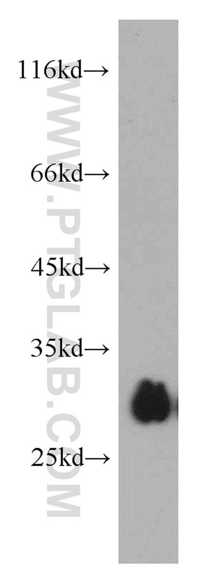 VDAC1/2 Antibody in Western Blot (WB)