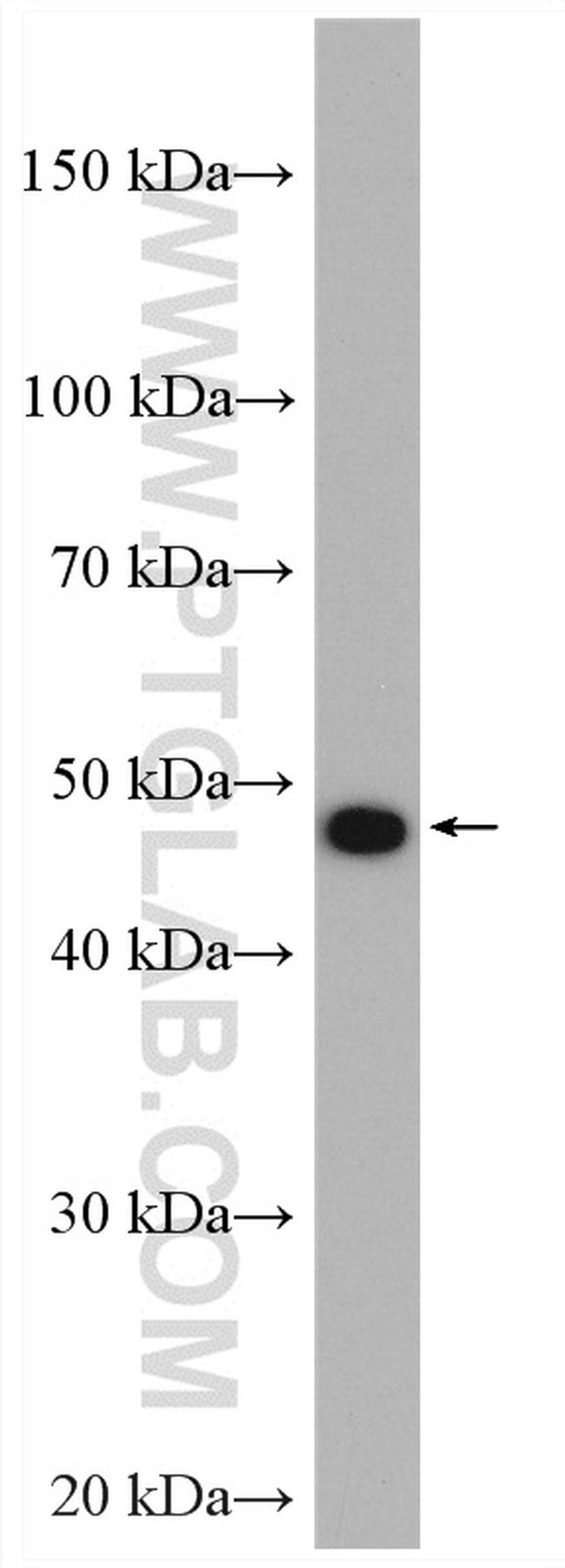 HSP47 Antibody in Western Blot (WB)