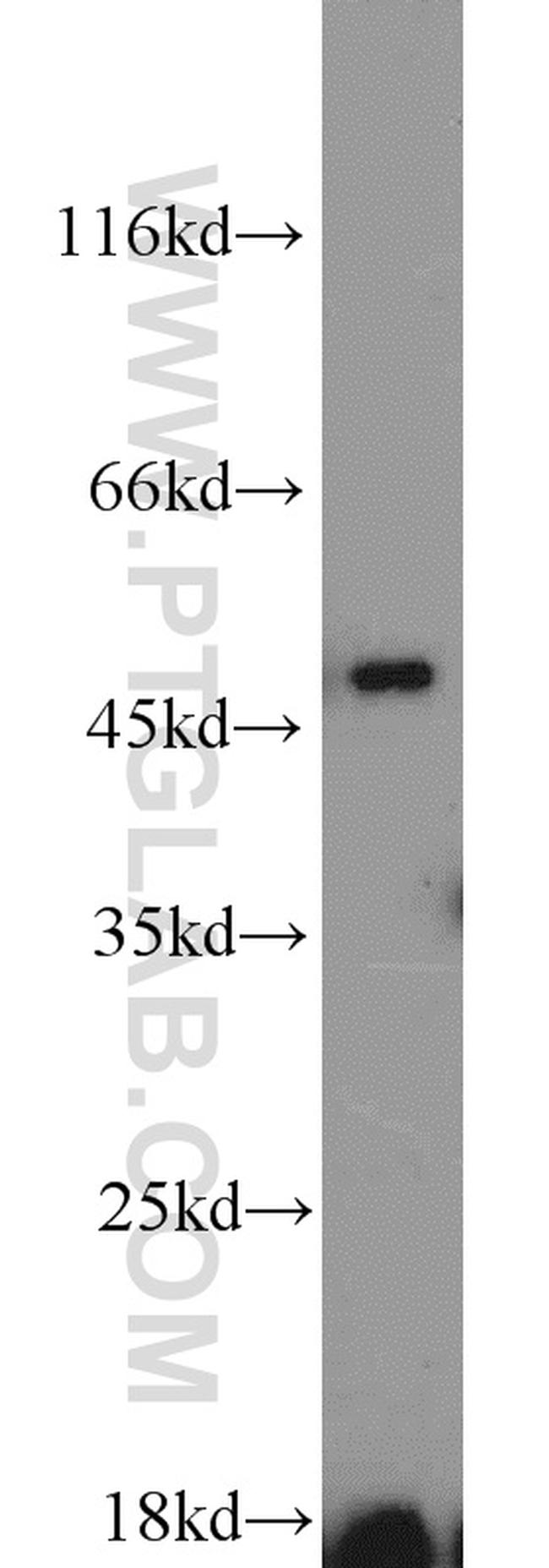 ETF1 Antibody in Western Blot (WB)