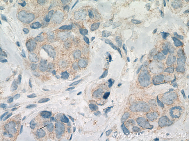 CNKSR1 Antibody in Immunohistochemistry (Paraffin) (IHC (P))