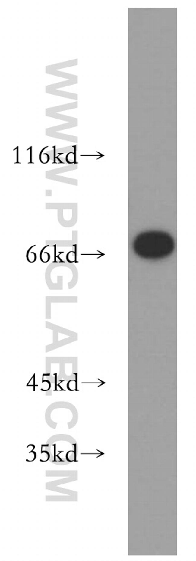 LMNB2 Antibody in Western Blot (WB)