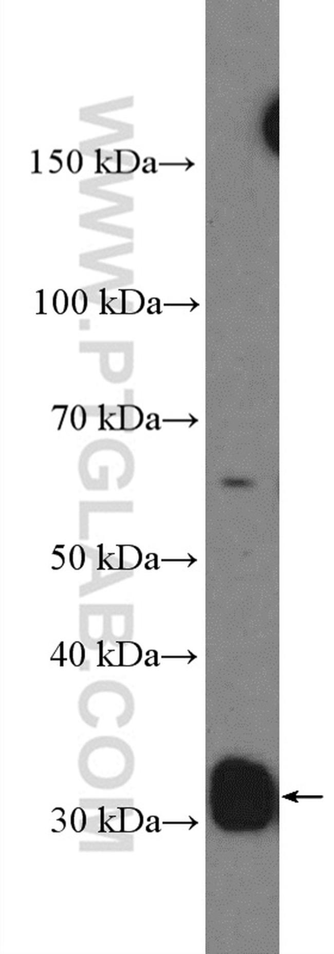 Cyclin D2 Antibody in Western Blot (WB)