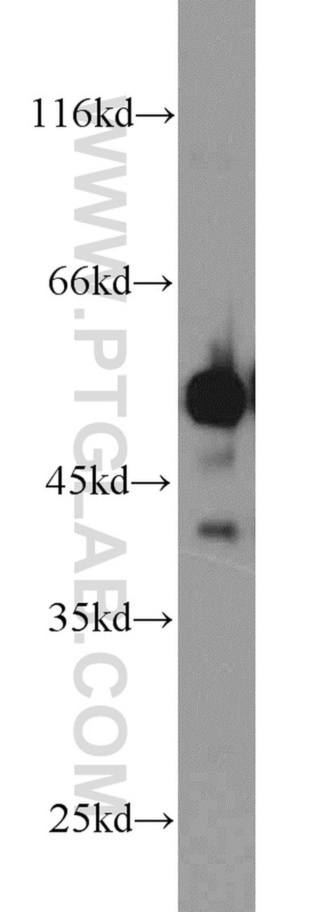 PDHX Antibody in Western Blot (WB)