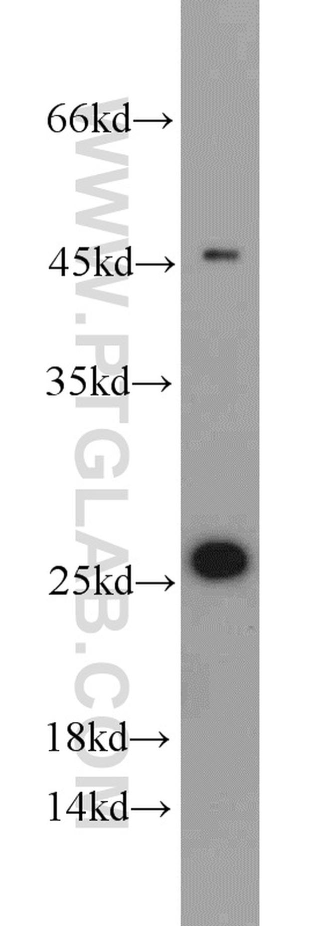 MESDC2 Antibody in Western Blot (WB)