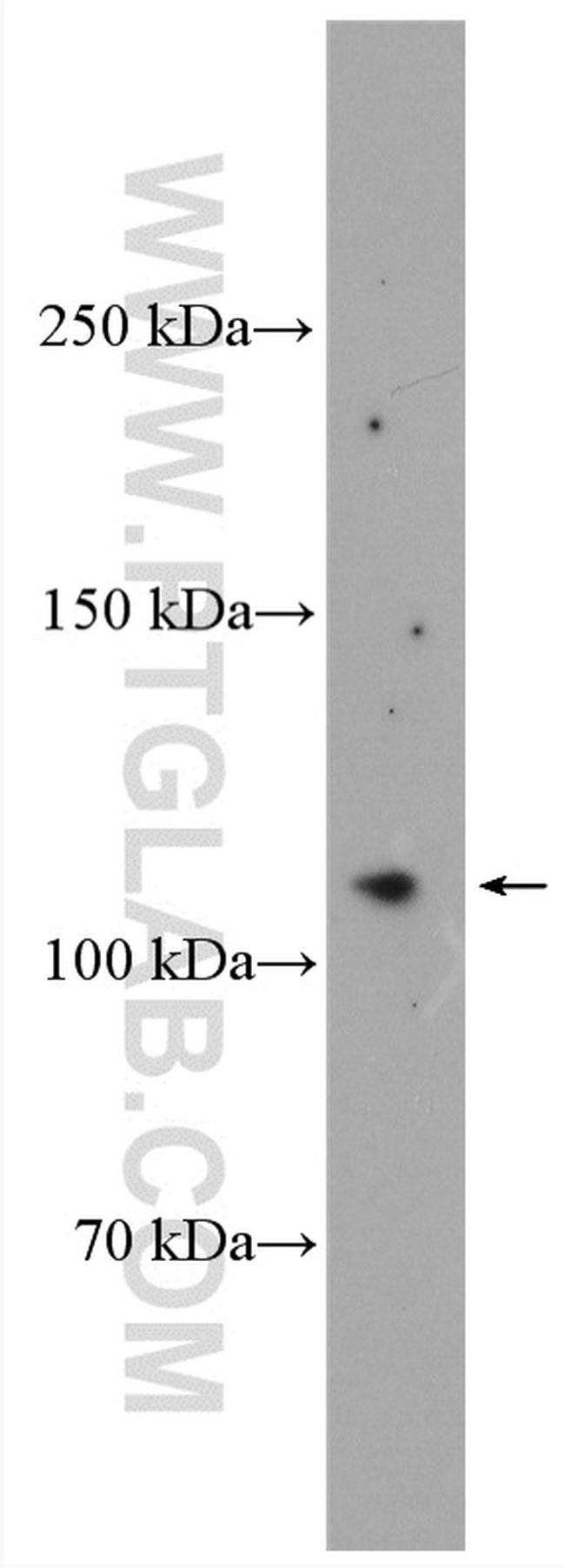 OSMR Antibody in Western Blot (WB)
