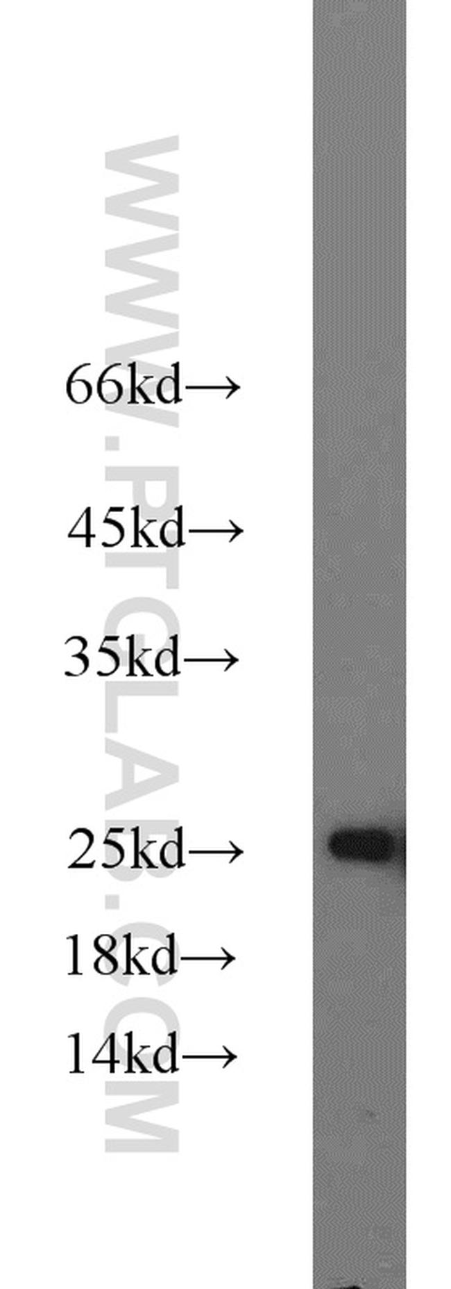 ATP5O Antibody in Western Blot (WB)