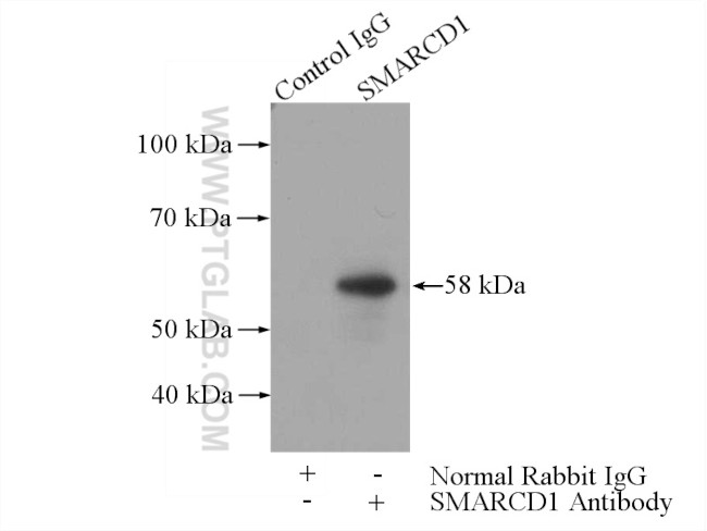 SMARCD1 Antibody in Immunoprecipitation (IP)