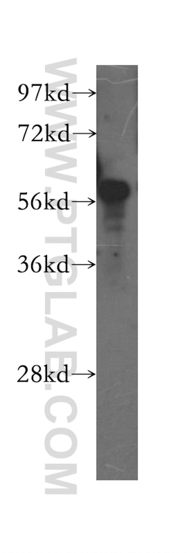 SMARCD1 Antibody in Western Blot (WB)