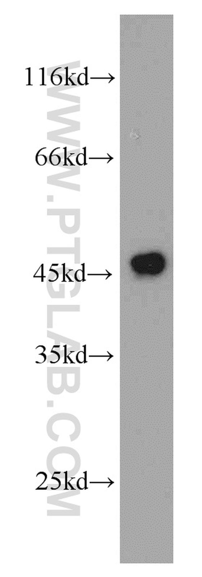 RPL3 Antibody in Western Blot (WB)