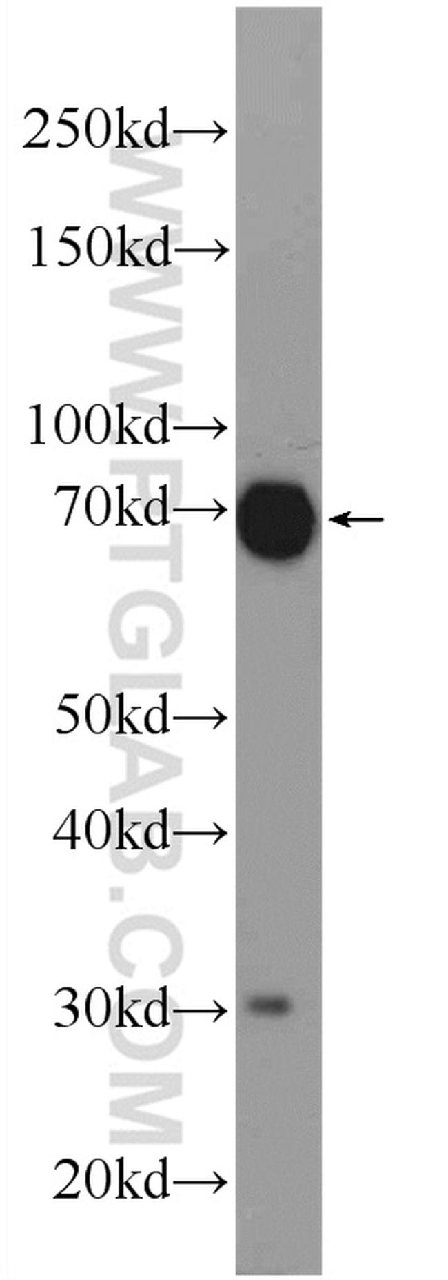 CA9 Antibody in Western Blot (WB)