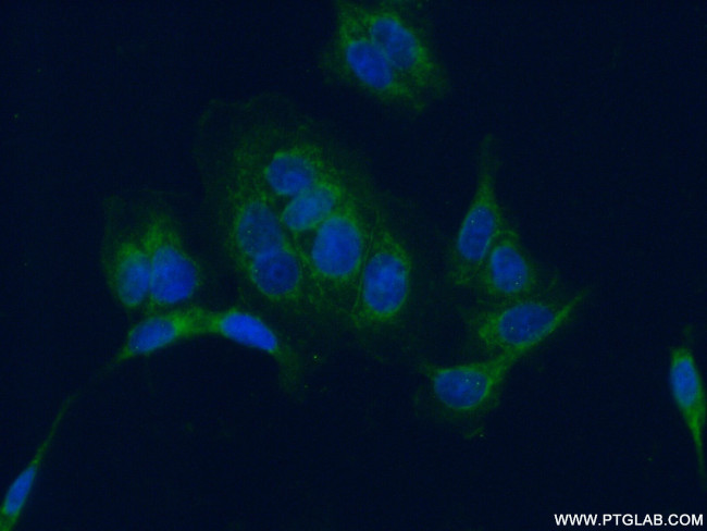 PARD3 Antibody in Immunocytochemistry (ICC/IF)