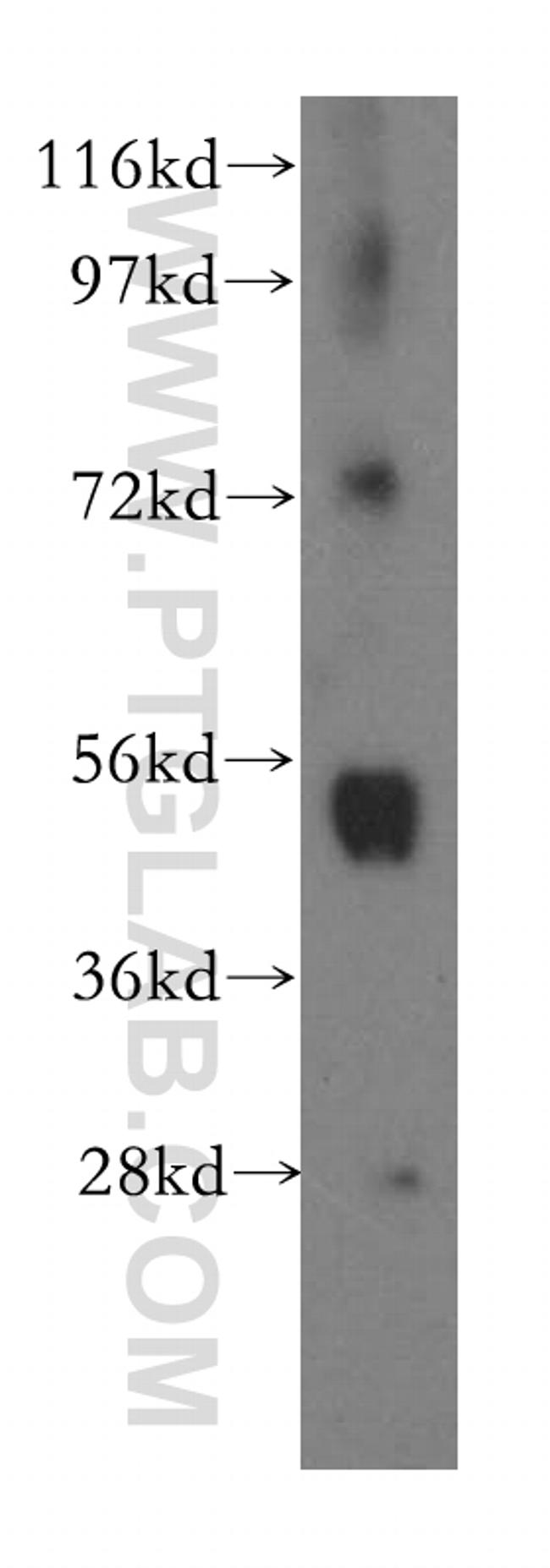 TXNRD1 Antibody in Western Blot (WB)