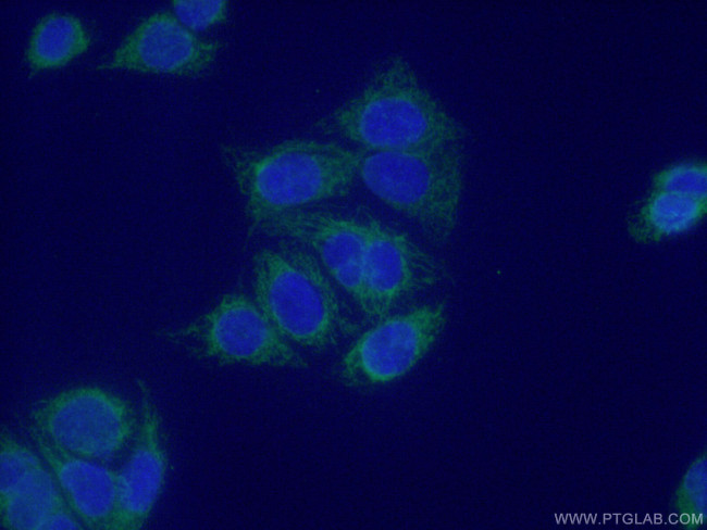 TIMM8A Antibody in Immunocytochemistry (ICC/IF)