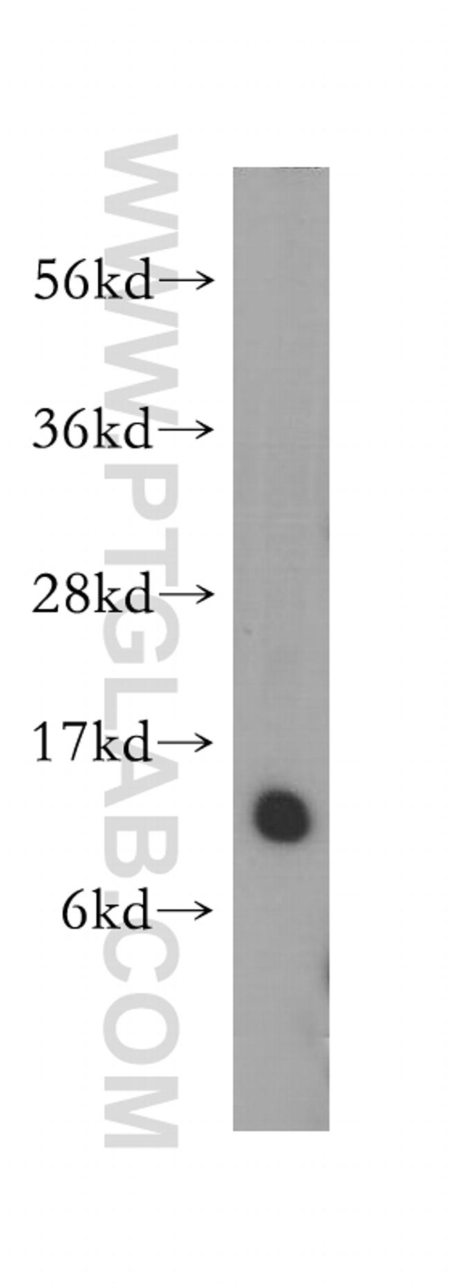 TIMM8A Antibody in Western Blot (WB)
