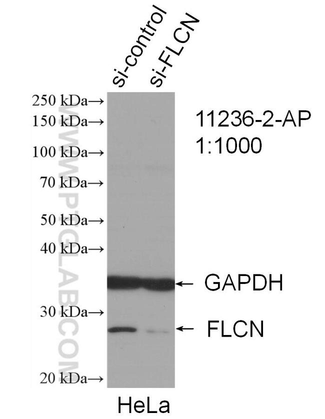 FLCN Antibody in Western Blot (WB)