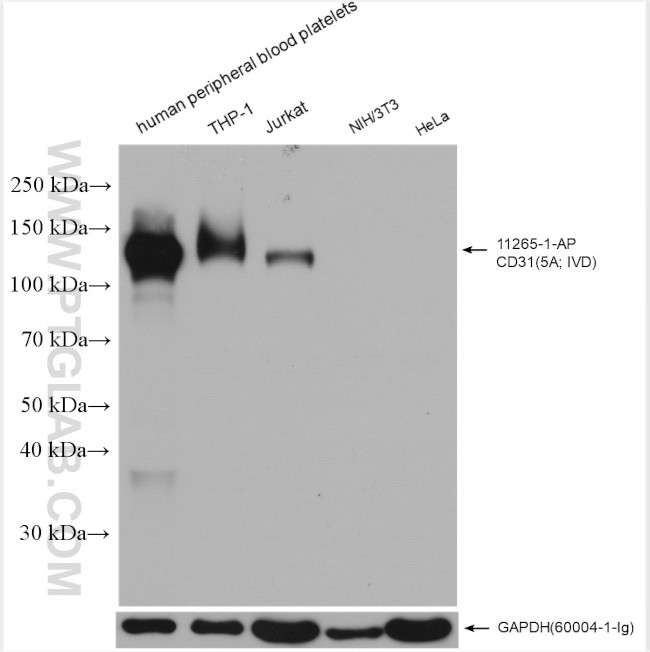 CD31 Antibody in Western Blot (WB)