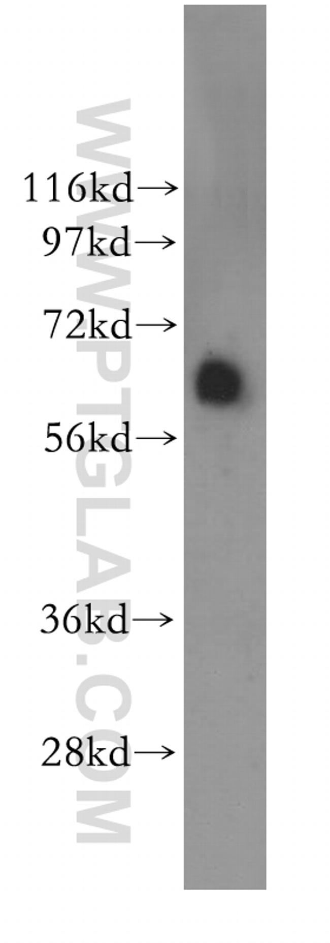 ASAH1 Antibody in Western Blot (WB)