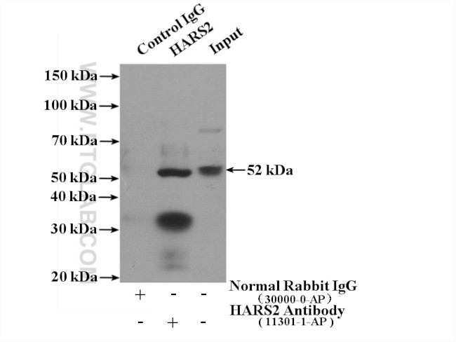 HARS2 Antibody in Immunoprecipitation (IP)
