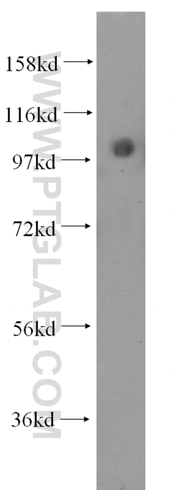 alpha Actinin Antibody in Western Blot (WB)