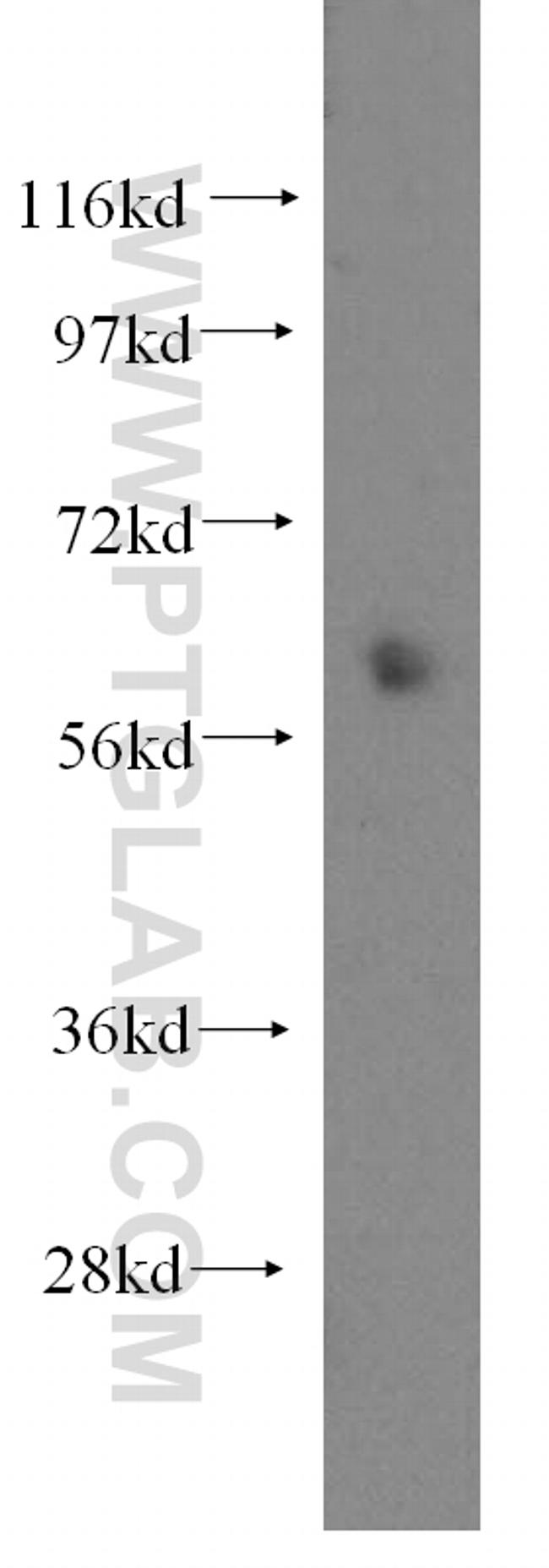 ENT1 Antibody in Western Blot (WB)