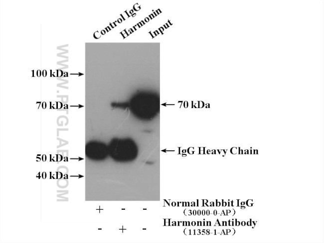 Harmonin Antibody in Immunoprecipitation (IP)