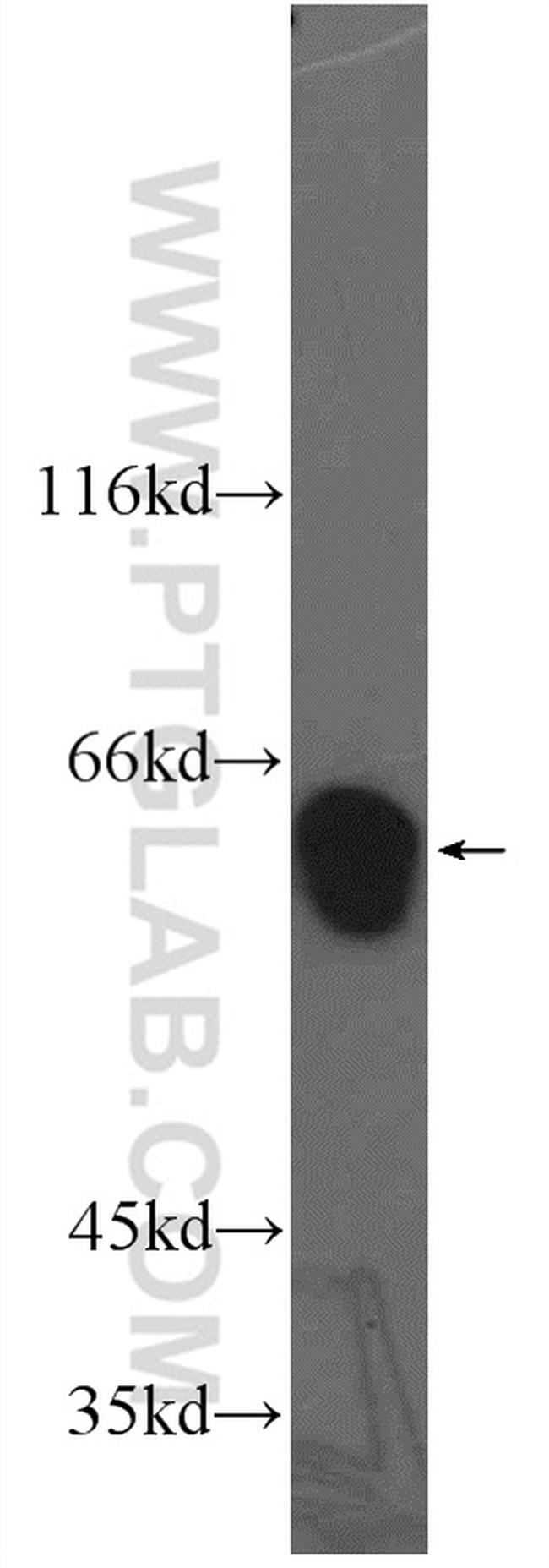 ARHGEF5 Antibody in Western Blot (WB)