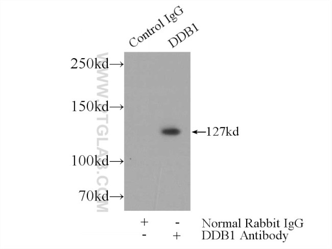 DDB1 Antibody in Immunoprecipitation (IP)