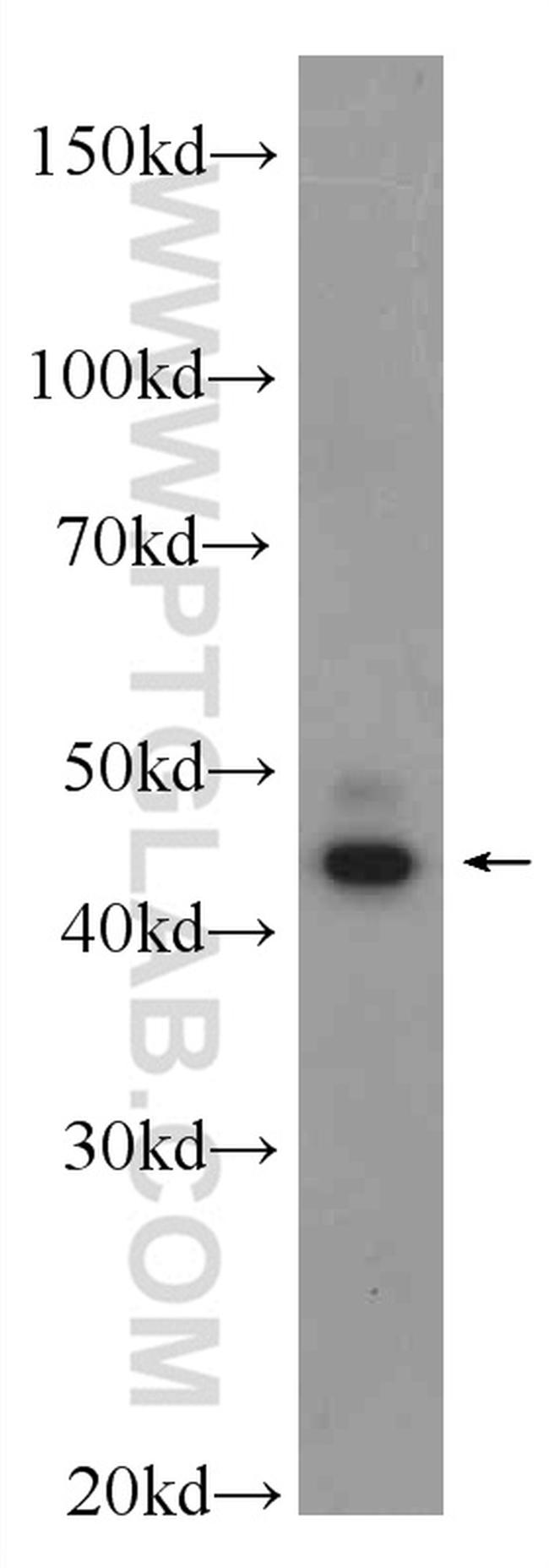 SEPT2 Antibody in Western Blot (WB)