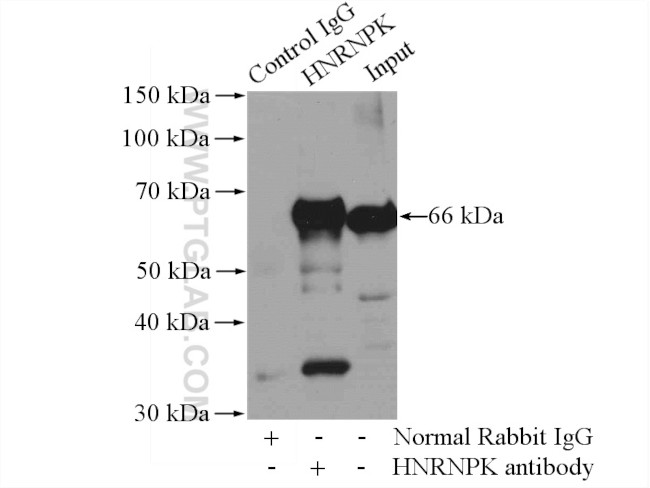 HNRNPK Antibody in Immunoprecipitation (IP)
