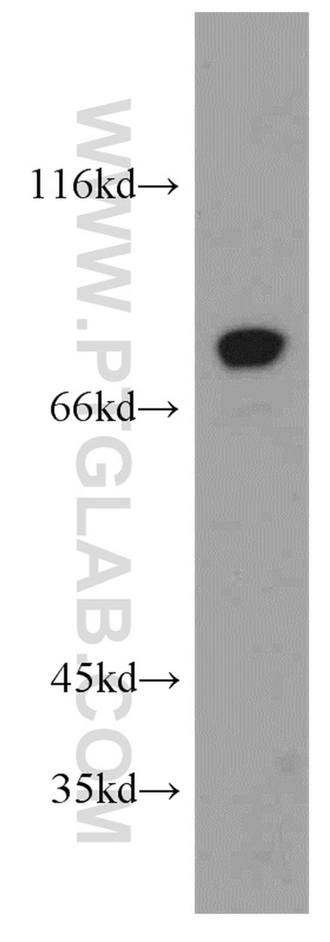 AGS3 Antibody in Western Blot (WB)
