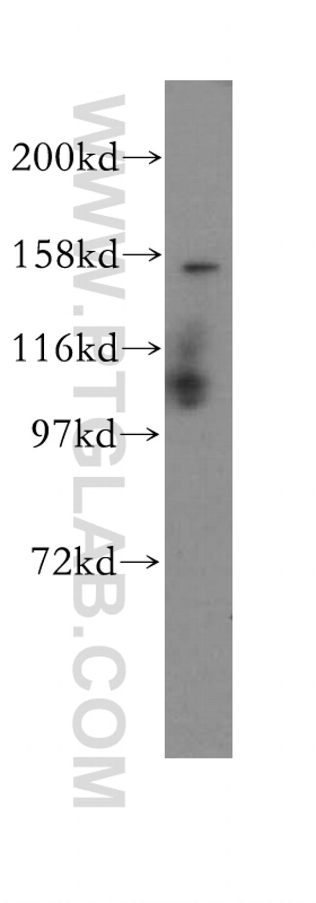 Symplekin Antibody in Western Blot (WB)