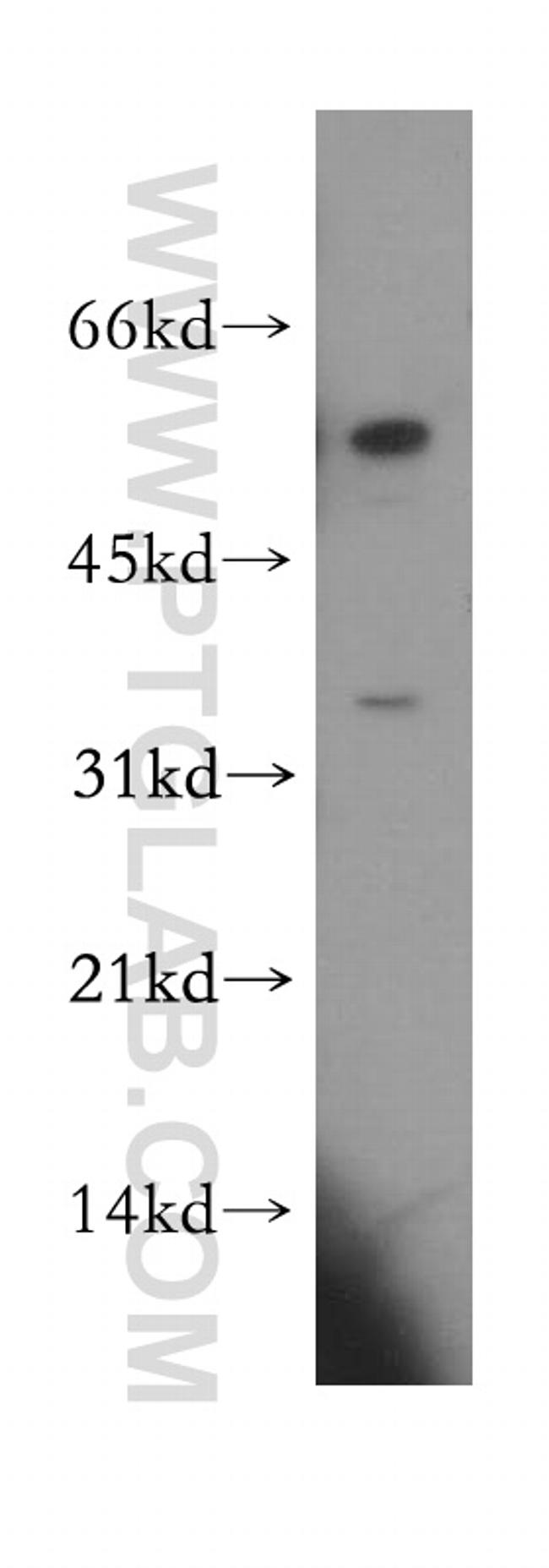 CCDC28B Antibody in Western Blot (WB)