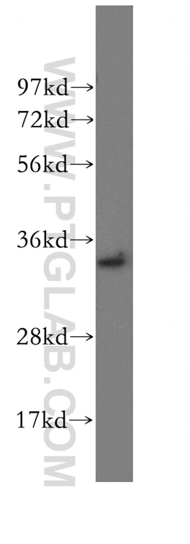 CCDC28B Antibody in Western Blot (WB)