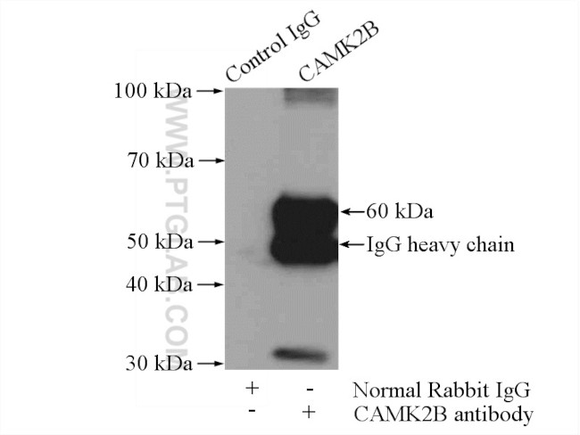 CaMKII beta Antibody in Immunoprecipitation (IP)