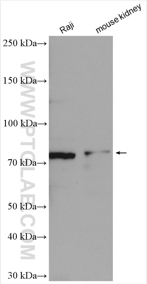 PLAGL2 Antibody in Western Blot (WB)
