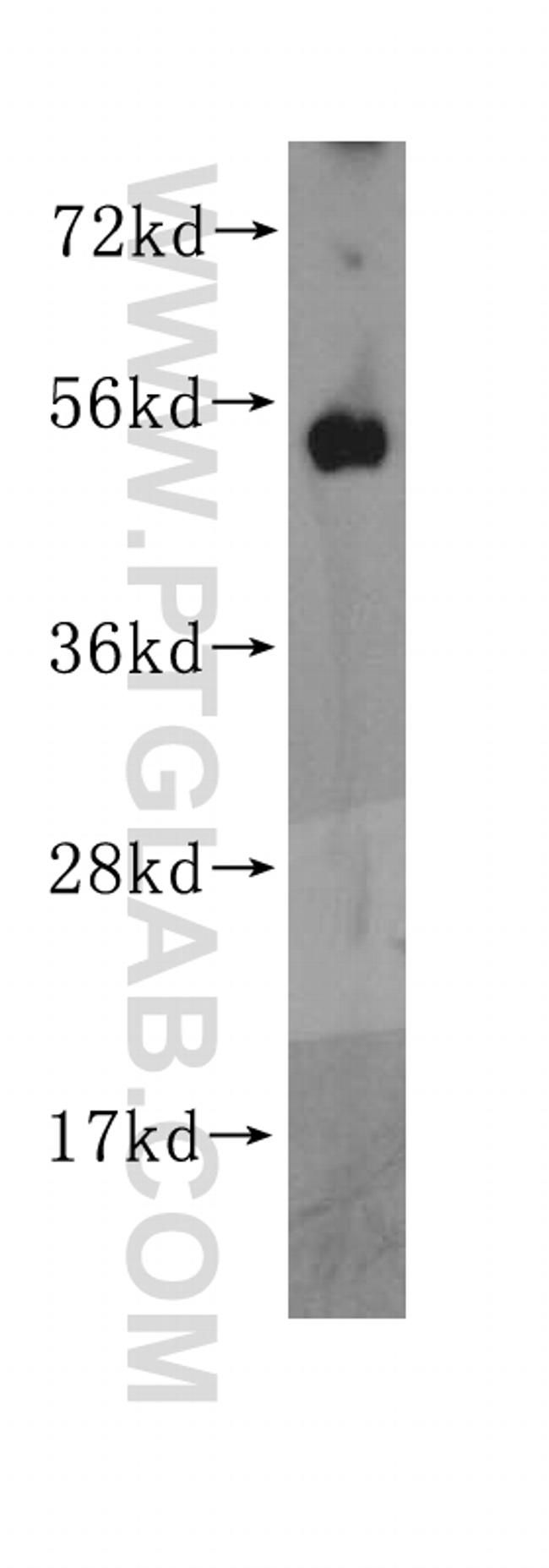 ORC5L Antibody in Western Blot (WB)