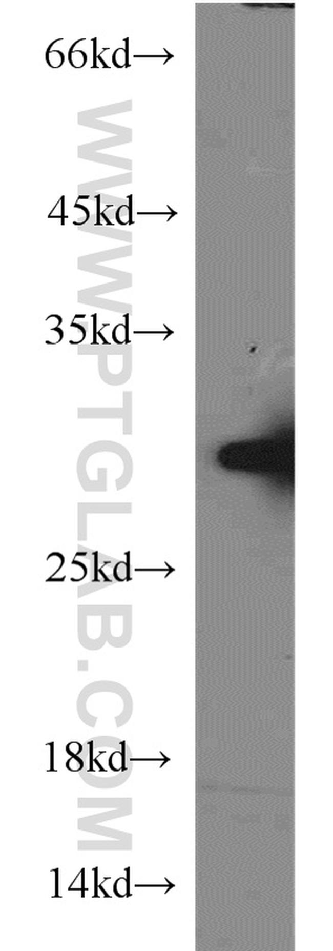 PSMA6 Antibody in Western Blot (WB)