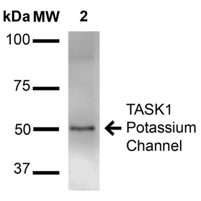 TASK1 Potassium Channel Antibody in Western Blot (WB)
