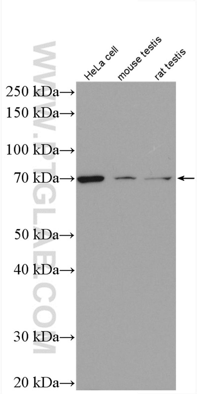 GRP78/BIP Antibody in Western Blot (WB)