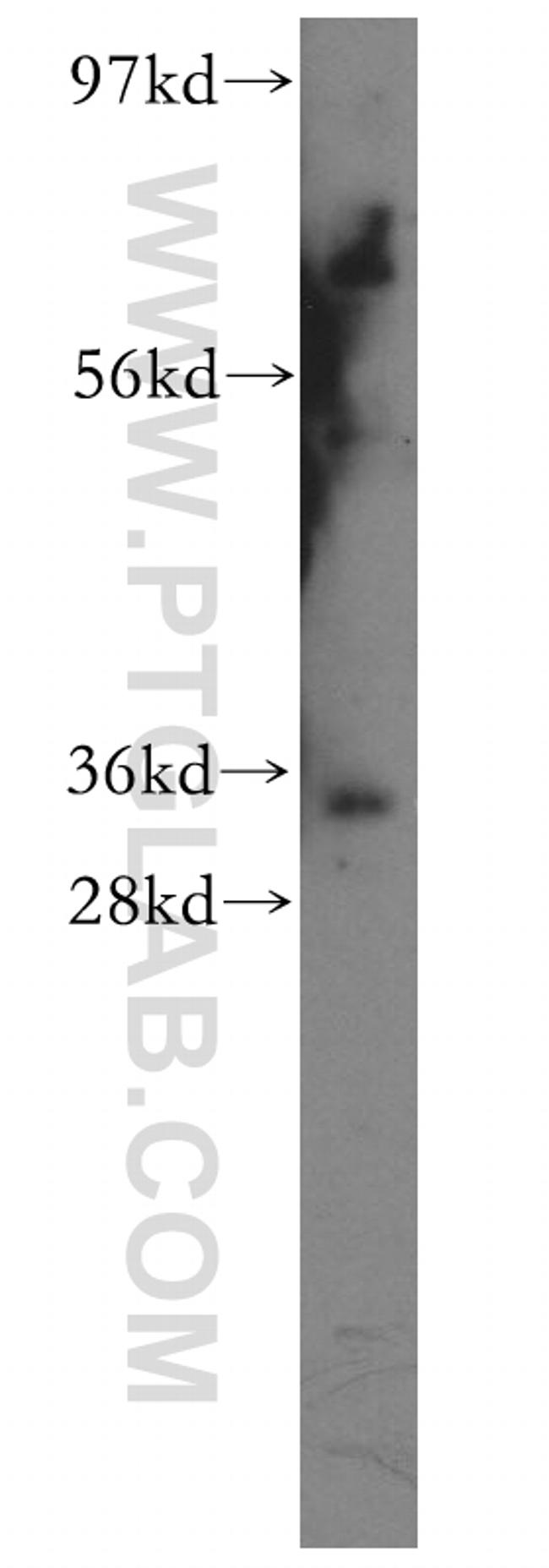 TFIIE beta Antibody in Western Blot (WB)