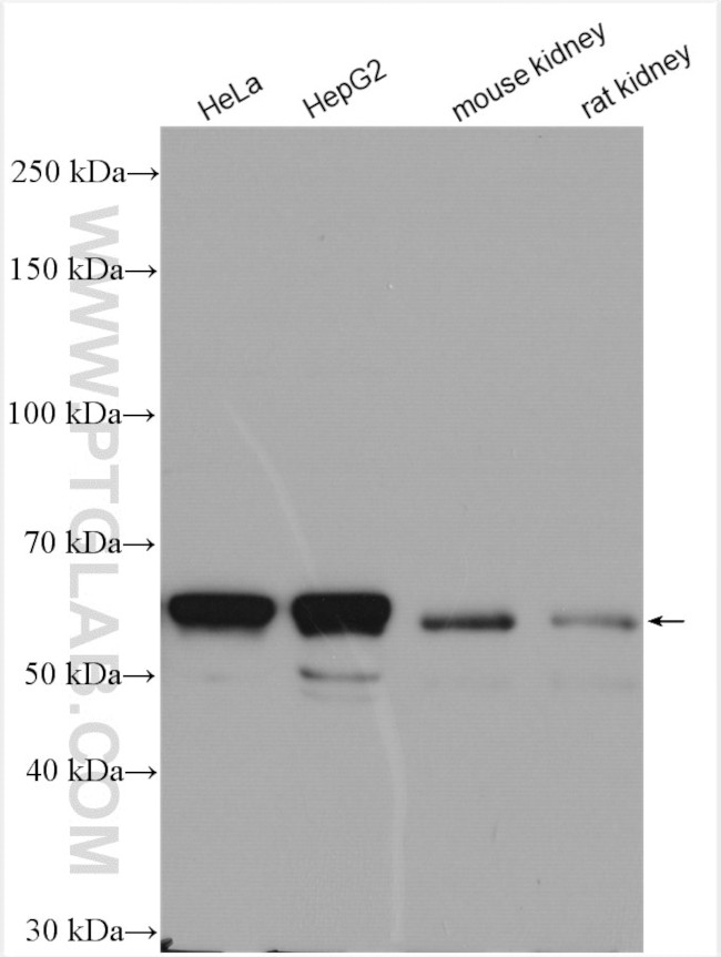 IGF2BP2 Antibody in Western Blot (WB)