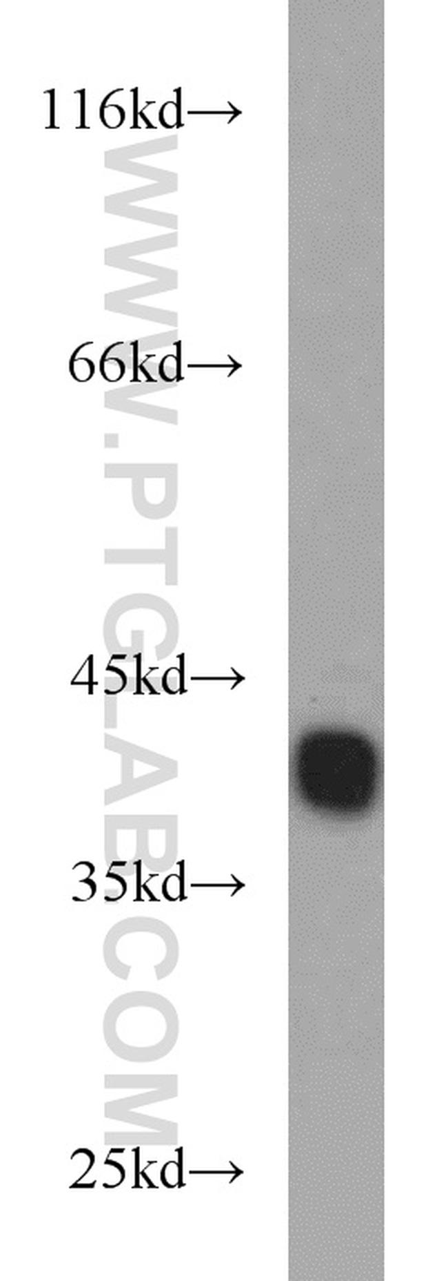 RBM4 Antibody in Western Blot (WB)