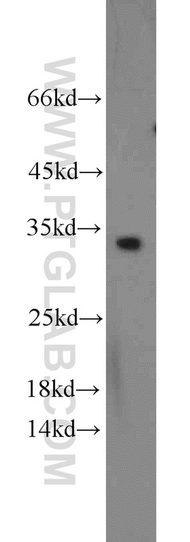 CDCA4 Antibody in Western Blot (WB)